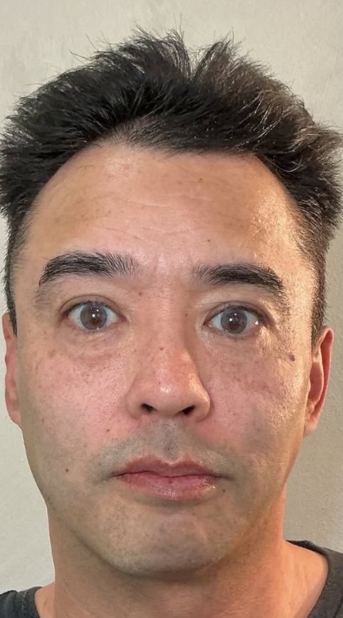 Rosto masculino de frente, mais firme, depois do XERF